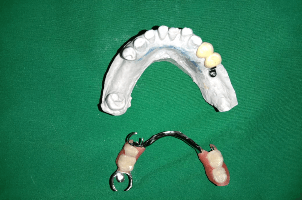 live Case